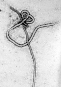 The Ebola virus particle