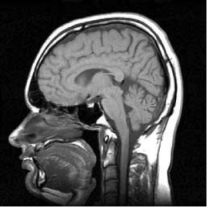 Source: http://commons.wikimedia.org/wiki/Brain#mediaviewer/File:MRI_head_side.jpg